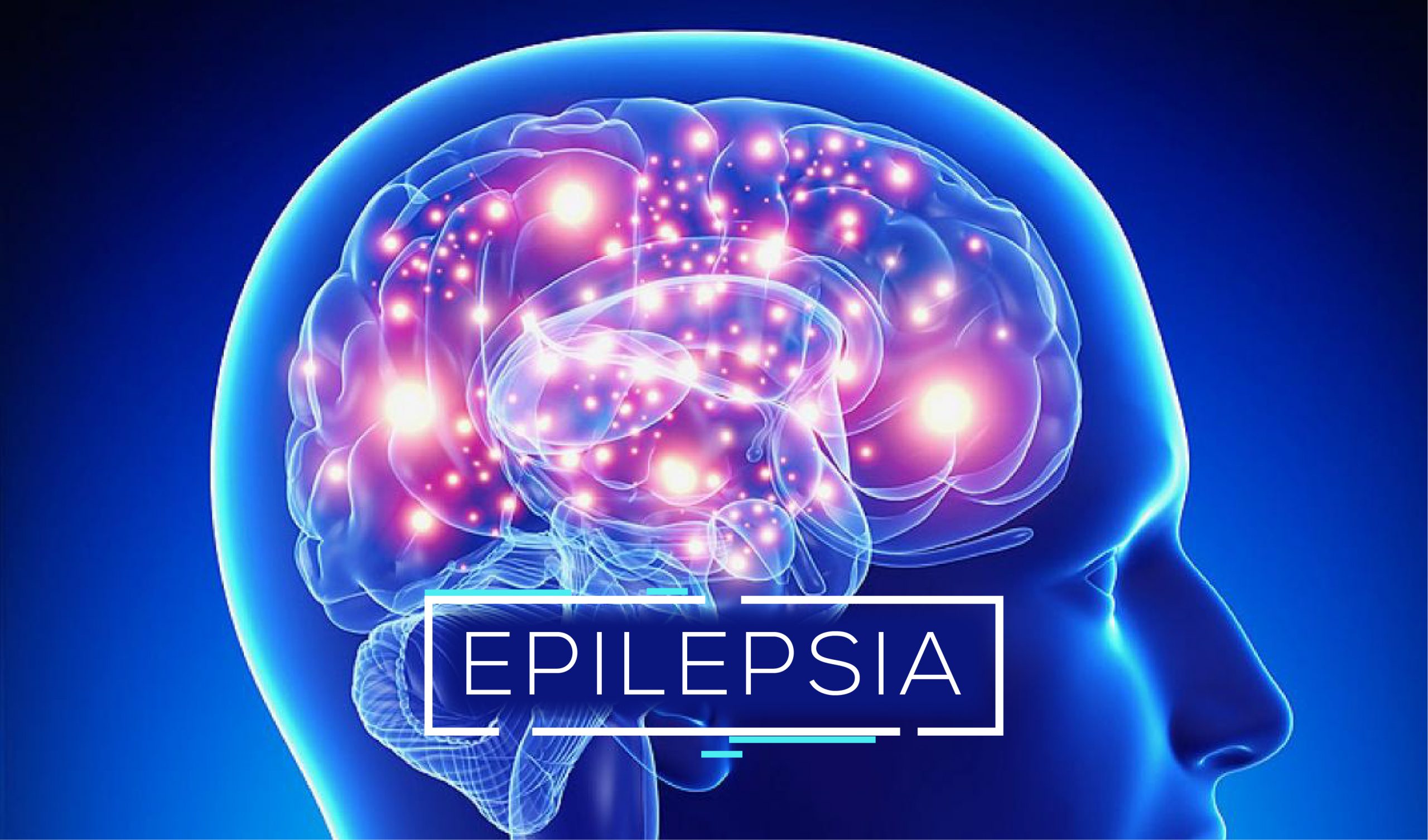 Sot shënohet Dita Ndërkombëtare Kundër Epilepsisë