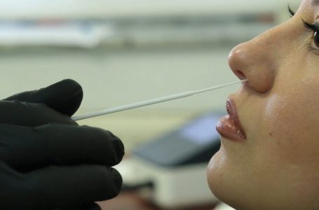 Fillojnë testet RAPID në komunën e Gjakovës