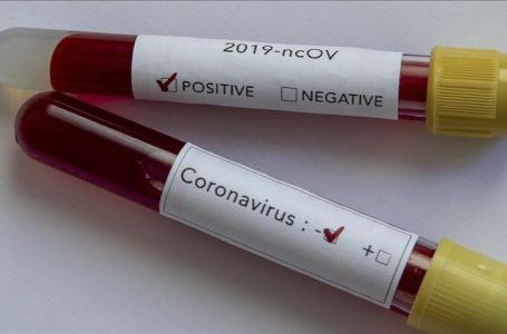​Danimarka konfirmon rritjen e rasteve me variantin britanik të koronavirusit