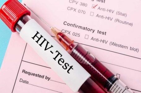 Shkencëtarët zbulojnë një variant të ri të HIV në Holandë