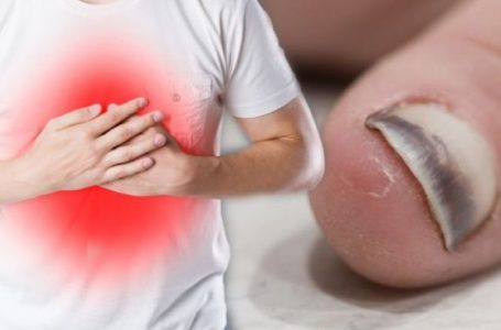 Presion i lartë i gjakut: Thonjtë, këmbët dhe venat tuaja mund të tregojnë rrezikun