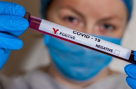 713 pacientë po trajtohen nga covid-19 në Kosovë