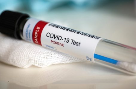 ​2 mijë e 140 të vdekur nga COVID-19 në Kosovë