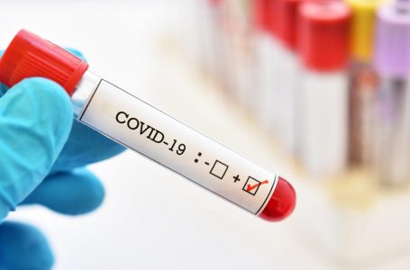 498 raste pozitve me covid-19 në vend, 27 raste në Gjakovë