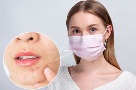 Epidemiologët: Patologjia e re e krijuar nga mbajtja e maskave