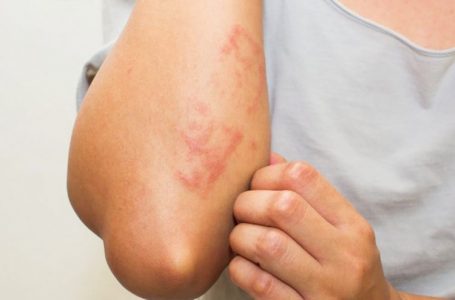 Rastet kur lëkura juaj po ju paralajmëron që diçka nuk po shkon si duhet me trupin