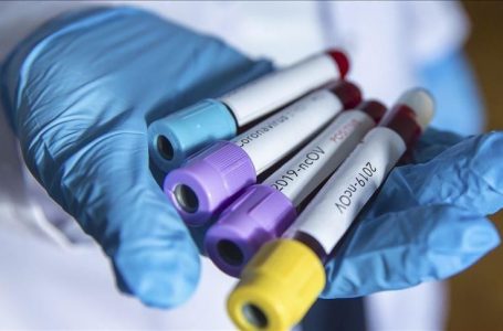 12 433 raste aktive me Coronavirus në Kosovë