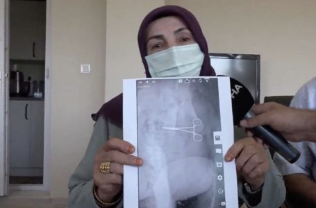 Gruaja nga Turqia përjeton dhimbjet e tmerrshme pasi kirurgu i harron gërshërët brenda në bark