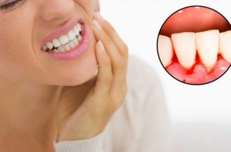 Mungesa e vitaminës C shkakton gjakderdhjen e mishit të dhëmbëve