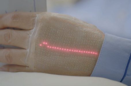 Lëkurë elektronike për të monitoruar shëndetin