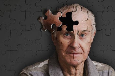 Aducanumab, pretendohet të jetë ilaçi i parë për të ngadalësuar zhvillimin e sëmundjes Alzheimer