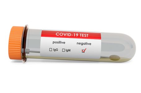 Pacientja e infektuar me variantin afrikan del negative në testin për COVID-19