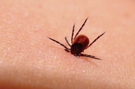 Pickimi i rriqrave po vazhdon të jetë një shqetësim, Malisheva prin me 626 raste