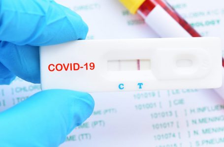 Raporti: Covid-19 doli nga një laborator kinez