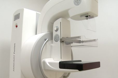 Gjakovë, 240 gra e kanë bërë mamografinë për parandalimin e kancerit të gjirit
