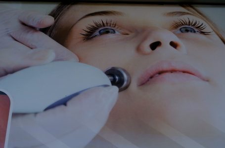 Kujdesi për lëkurën gjatë dimrit