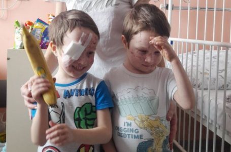 Nëna dhe binjakët e saj rikthejnë shikimin pasi u bombarduan nga forcat ruse, njëri prej tyre humbi syrin