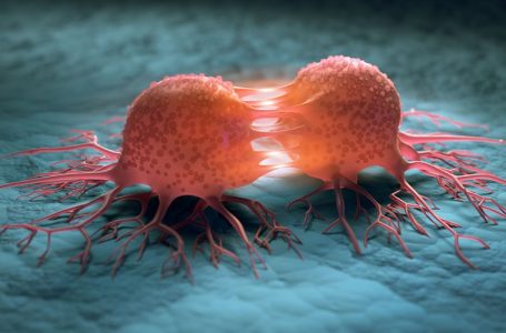 Hulumtimi i ri nga Yale identifikon shkaqet e kancerit