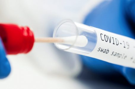 Për një javë u dyfishuan infektimet me COVID-19 nga 106 në 213