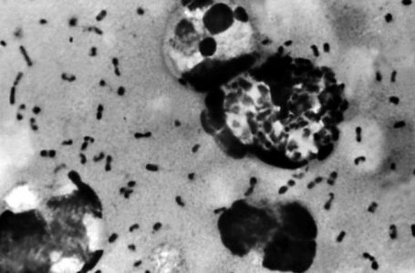 Gjendet origjina e pandemisë më të rëndë që ka kaluar njerëzimi