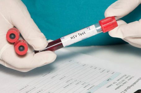 OBSH: Evropa duhet të vazhdojë luftën kundër HIV/AIDS-it