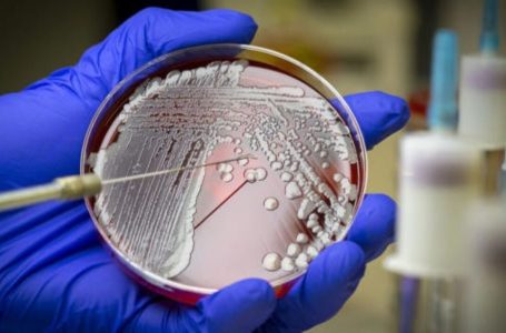 Shkencëtarët përdoren inteligjencën artificiale për të zhvilluar një antibiotik kundër superbaktereve