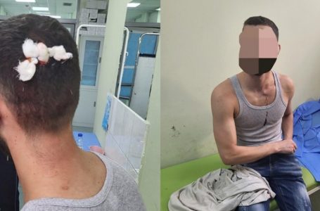Grupet kriminale në veri sulmojnë dy persona meshkuj kosovarë