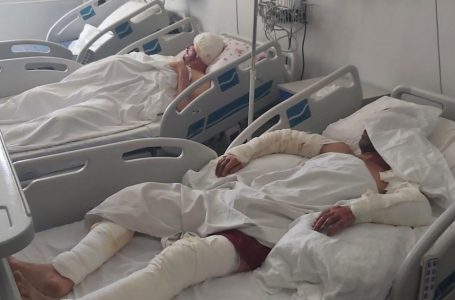 Mungon qendra për djegie, mbingarkohet Kirurgjia Plastike