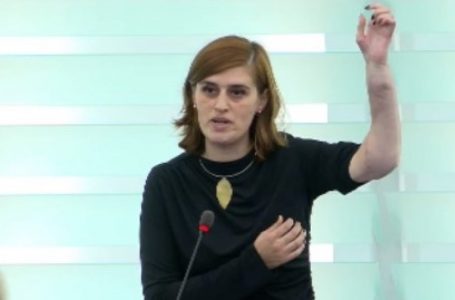 Bogujevci në KiE tregon shenjat e mbetura në duar nga plumbat e ushtrisë serbe (VIDEO)