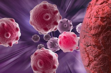 Çfarë ndodh kur qelizat e kancerit largohen nga tumori primar