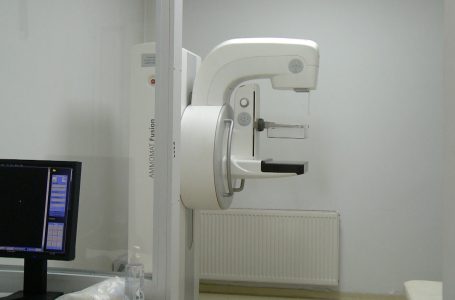 Bie interesimi për bërjen e mamografisë