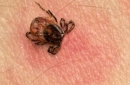 Sëmundja Lyme rrit rrezikun për shkak të ndryshimeve klimatike