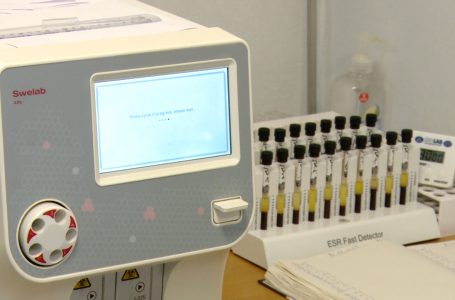 Qendra e Mjekësisë Familjare 1, me kapacitete të mjaftueshme për të kryer analiza laboratorike