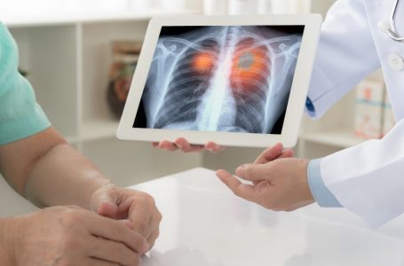 Pacientët evropianë kanë filluar të marrin vaksinën e parë në botë kundër kancerit të mushkërive