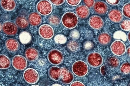 OBSH e shpall linë e majmunëve një emergjencë globale të shëndetit publik
