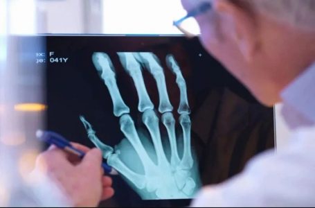 Inteligjenca artificiale ndihmon doktorët t’i identifikojnë eshtrat e thyera më lehtë
