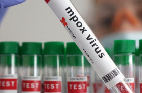 Gjermania identifikon rastin e saj të parë të variantit të ri mpox, raporton Bild