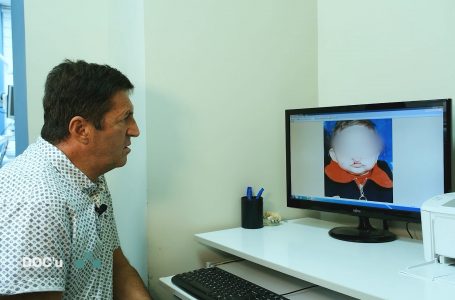 Dr. Domi: Shumë njerëz quditen se si mund të vdes njeriu prej dhëmbit