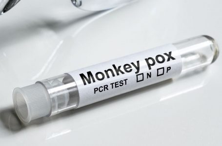 Mbretëria e Bashkuar konfirmon dy raste të llojit të ri mpox në transmetimet e para shtëpiake në Evropë