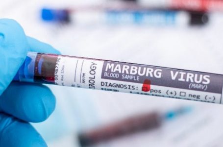 Shfaqet një virus i ri vdekjeprurës