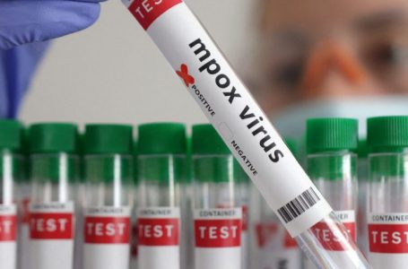 Zbulohet një rast i ri me virusin Mpox në Britaninë e Madhe